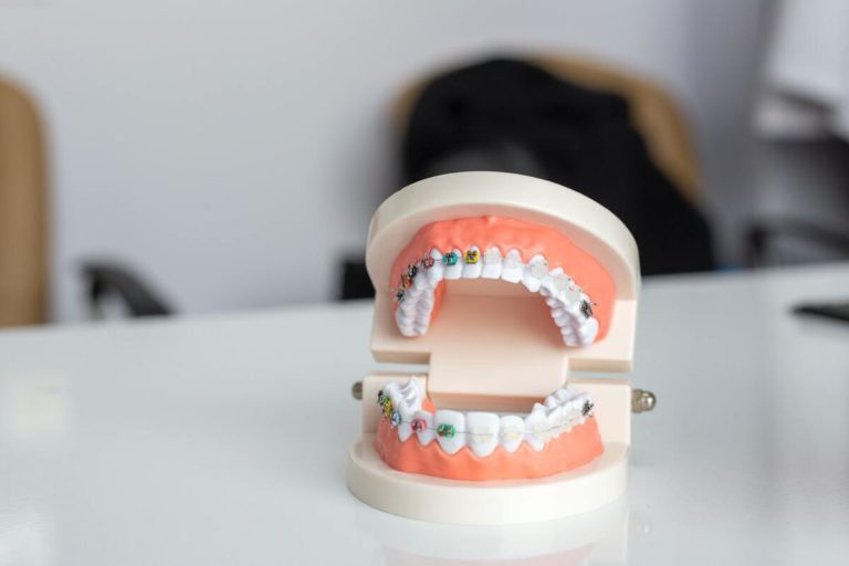 model of teeth with braces